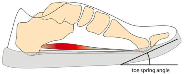 Toe Spring High Pain in your big toe - osteoarthritis - Bradford District Care NHS ...