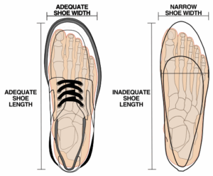 Graphic showing appropriate shoes for morton's neuroma