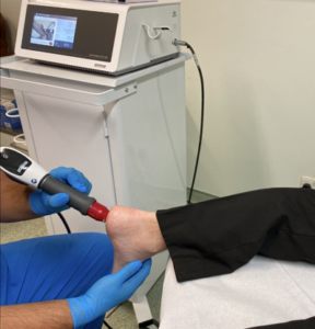 Photograph of a podiatrist using a shockwave therapy device to treat a patient's heel